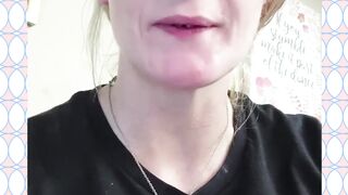 veneers 2