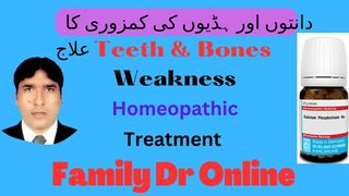 How To Treatment Of Teeth & Bones Problem with Calcium Phos Bio Chemic Homeopathy Medicine