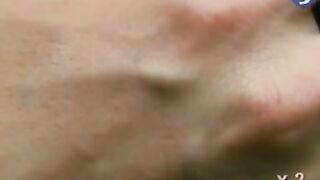 HAND SKIN