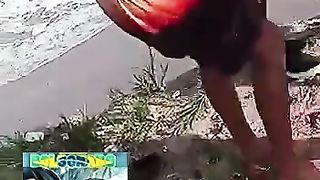 Ataque de tubarão em olinda deixar homem com a perna feridas