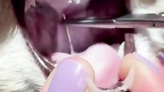 Sewing needle ðª¡ REMOVED from Cat