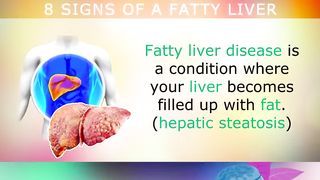 Signs of Fatty Liver