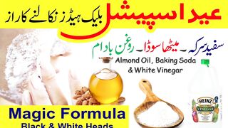 How to Remove Blackheads From Nose & Face || Naturally at Home || Beauty Tips In Urdu