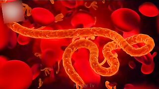 #Most #Dangerous #Viruses In #Human #History #Hindi / #Urdu