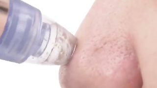 Yuck removal