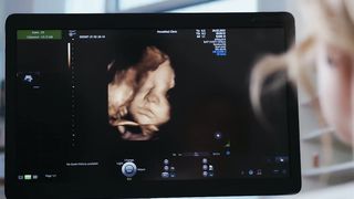 Modern Ultrasonography and its clarity