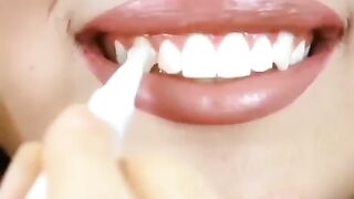 Teeth whitening gel pen