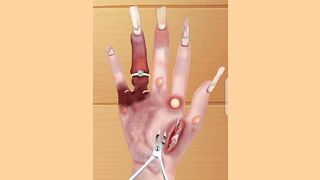 asmr hand treatment||ASMR HAND TREATMENT
