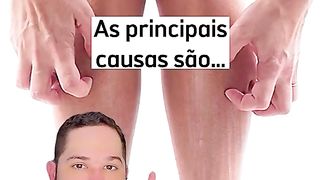 Coceiras na pele depois do banho