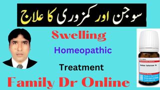 How to Treatment Of Swelling with kalium Sulfuricum Homeopathy Medicine