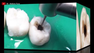IMPRESSIVE dental restoration in 4K