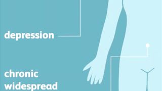 Fibromyalgia short video