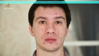 All face problem fenesh in this video