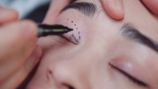 A doctor making a line to cut it