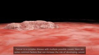 What is cancer . Types of cancer .