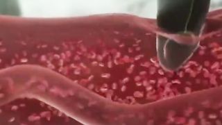3D Animation of Malaria