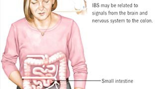 IBS overview