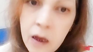 TikTok SK 81