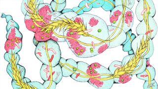 Celiac disease symptoms, causes, diagnosis & treatment