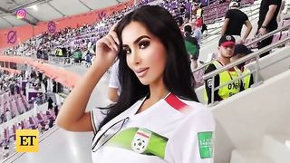 Kim Kardashian Look-Alike Dies Of Cardiac Arrest After Plastic Surgery!