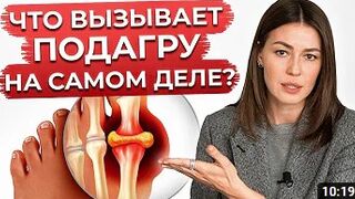 Это разрушает ваши суставы! / Что НЕЛЬЗЯ есть при подагре?