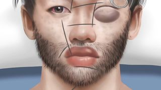 Makeup animation video #asmr #freshyasmr #removalanimation #detalcare #tartarremoval 4