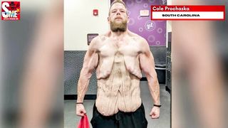 HE LOST 150 KILOS American suffers weight loss shock