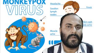 monkey pox shocking facts with history