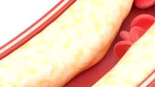 3 Ways to Lose Stubborn Fat Faster.