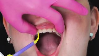 Professional processes of creating personal grillz! So fascinating!