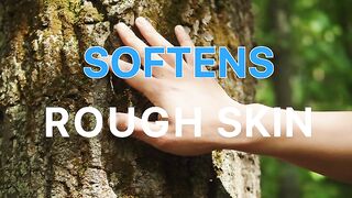 Ebanel Urea Cream|Foot Cream | Cracked Feet Heels Knees Elbows Hands Repair
