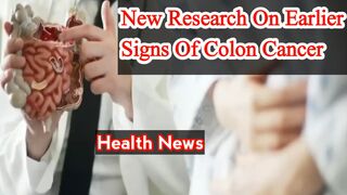 New research identifies the early signs of colon cancer