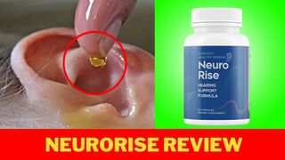 NeuroRise  - NeuroRise  REVIEWS -  Support hearing with NeuroRise – Buy NeuroRise