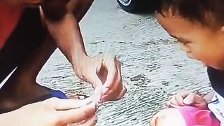 Sakit dek