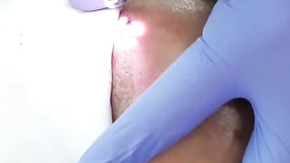 remove eyebrow tattoo