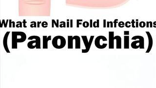 Paronychia overview