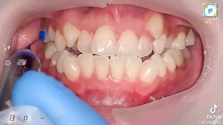 Teeth tacenolgy Pakistan ma????????