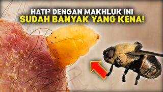 Waspada Lalat Botfly, Begini Cara Lalat Botfly Memasukan Maggot ke Tubuh Manusia