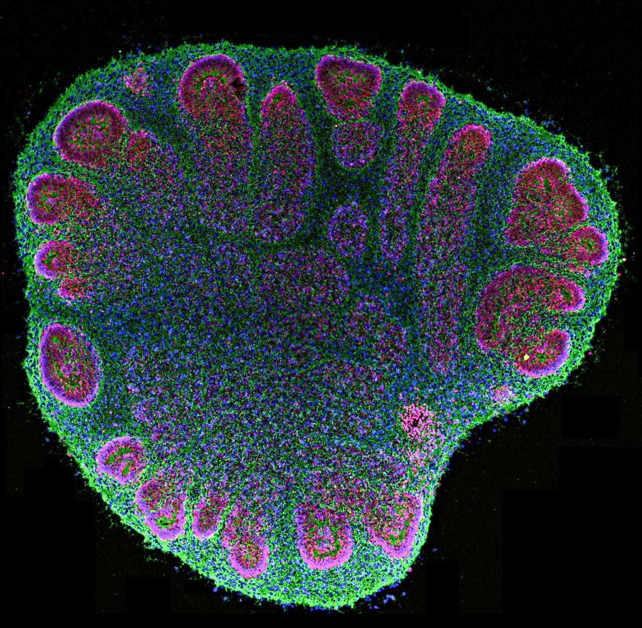 Pea-size human brain organoids spark hope and ethical concern — Npr.brightspotcdn.com
