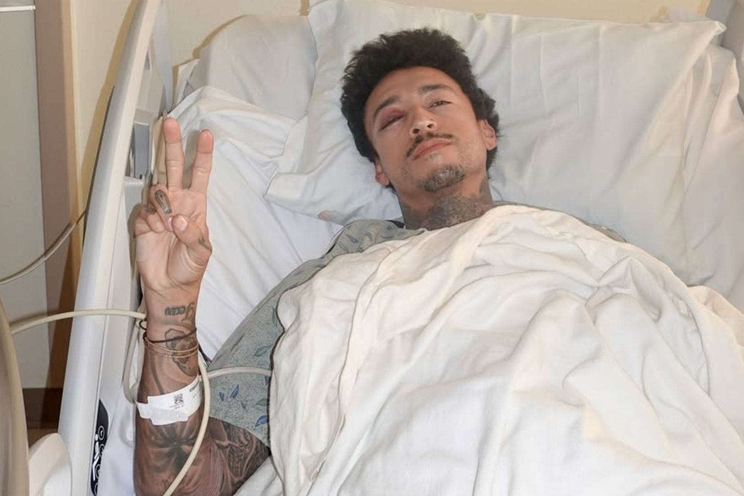 Nyjah Huston hospitalized after fracturing skull and eye socket — People.com