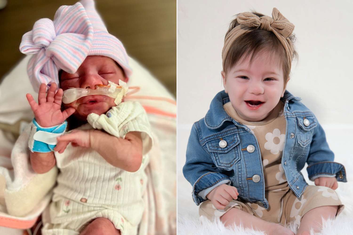 Preemie Norah Survived After Twin's Death and Is Thriving a Year Later — People.com