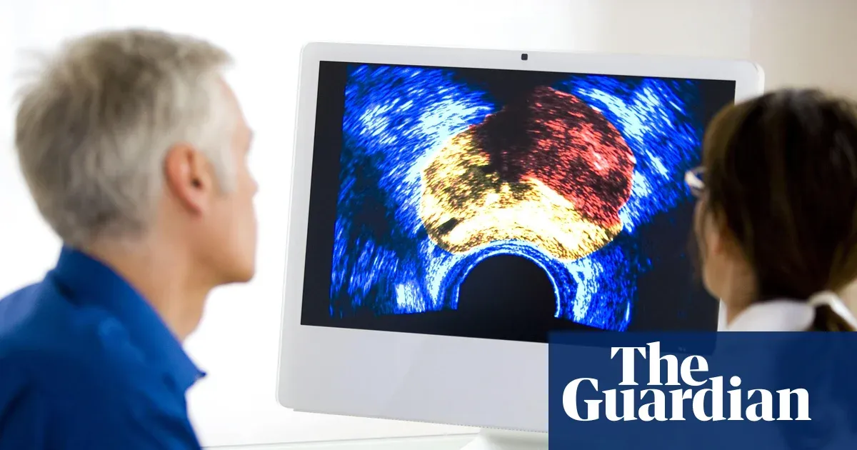 Prostate cancer now most diagnosed cancer in UK, charity analysis finds — I.guim.co.uk