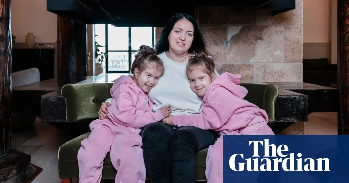 Mother describes daughters born conjoined at the head and later separated — I.guim.co.uk
