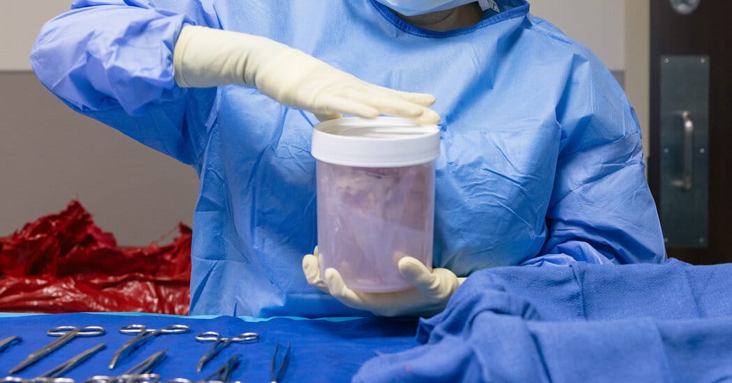 Federal oversight linked to sharp drop in skipped transplant patients — Static01.nyt.com