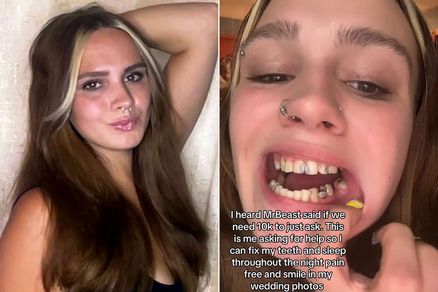 Ohio woman posts TikTok dances to raise money for dental implants — People.com