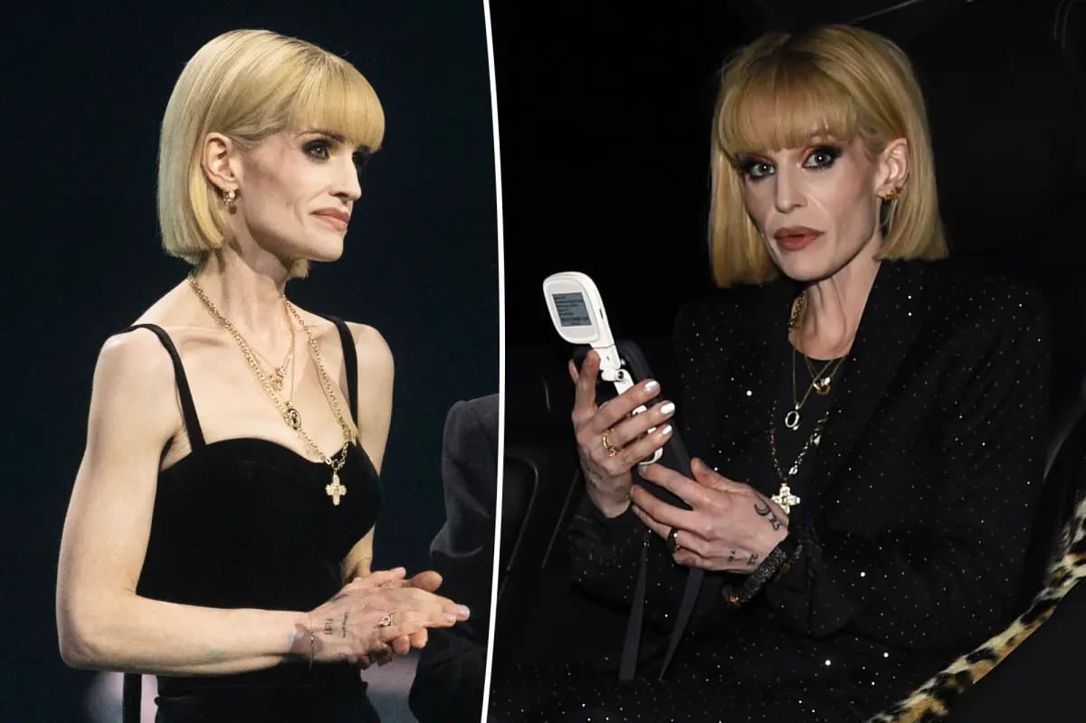 Kelly Osbourne issues scathing statement to body‑shaming trolls — Pagesix