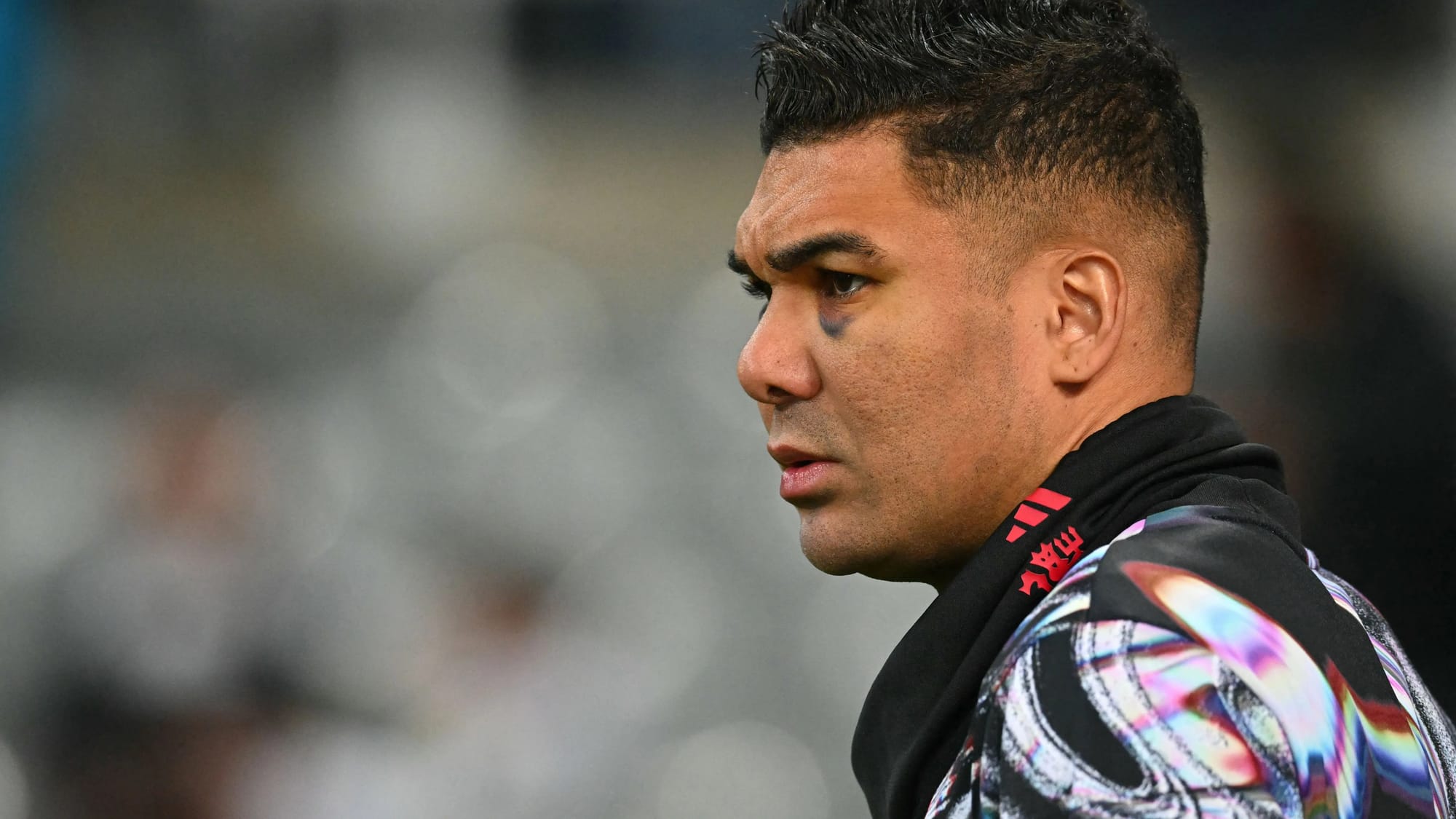 Casemiro's black eye traced to Palace collision as he plays through injury — Goal