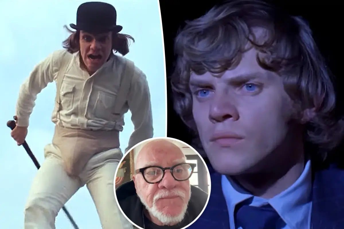 Malcolm McDowell says sudden fame after 'A Clockwork Orange' frightened him — Pagesix