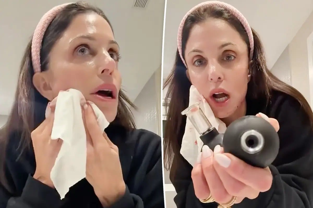 Bethenny Frankel slices face with beauty tool bought on social media — Pagesix