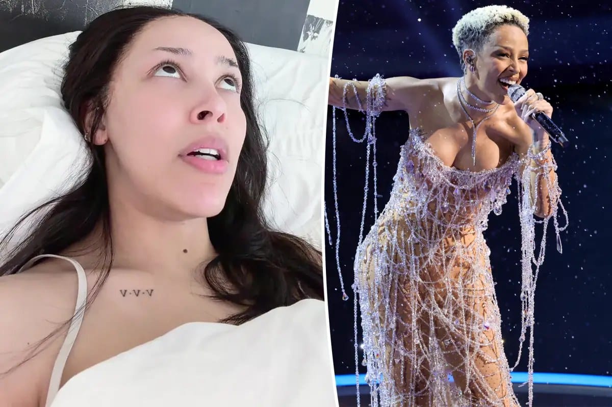 Doja Cat says she's 'struggling' with borderline personality disorder — Pagesix